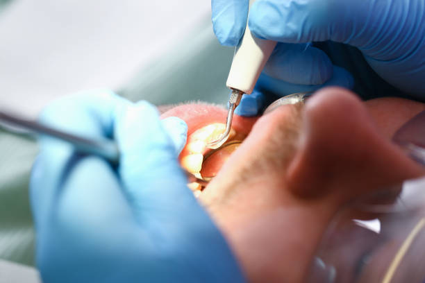 Best Dentist for Tooth Abscess  in Thompsonville, PA